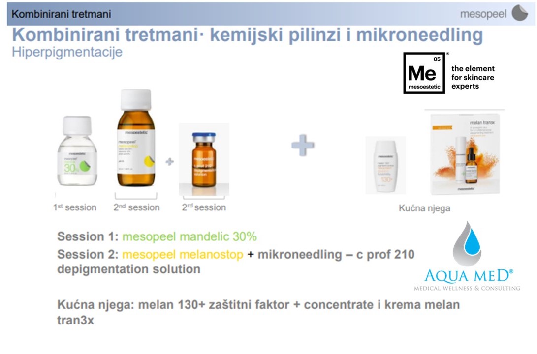 2. Kombinirani tretmani microneedling i kemijski piling 2