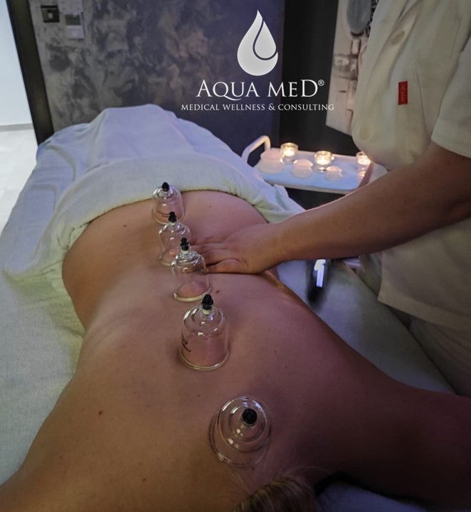 Aqua Med Cupping