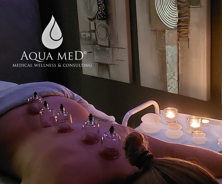 Aqua Med Cupping 3
